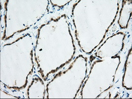 TTC32 Antibody in Immunohistochemistry (Paraffin) (IHC (P))