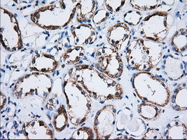 TTC32 Antibody in Immunohistochemistry (Paraffin) (IHC (P))