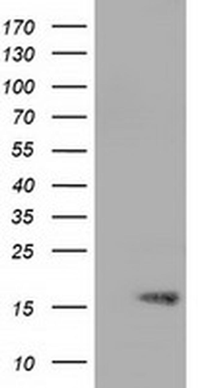 TTC32 Antibody in Western Blot (WB)