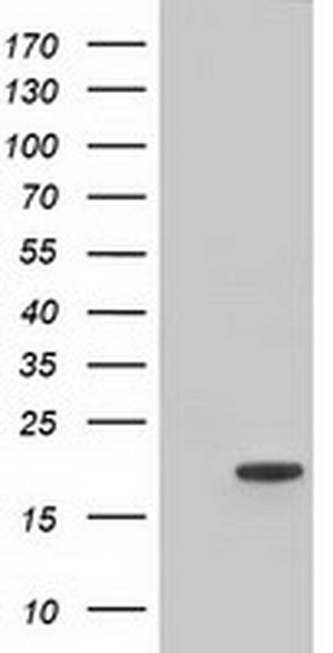 TTC32 Antibody in Western Blot (WB)