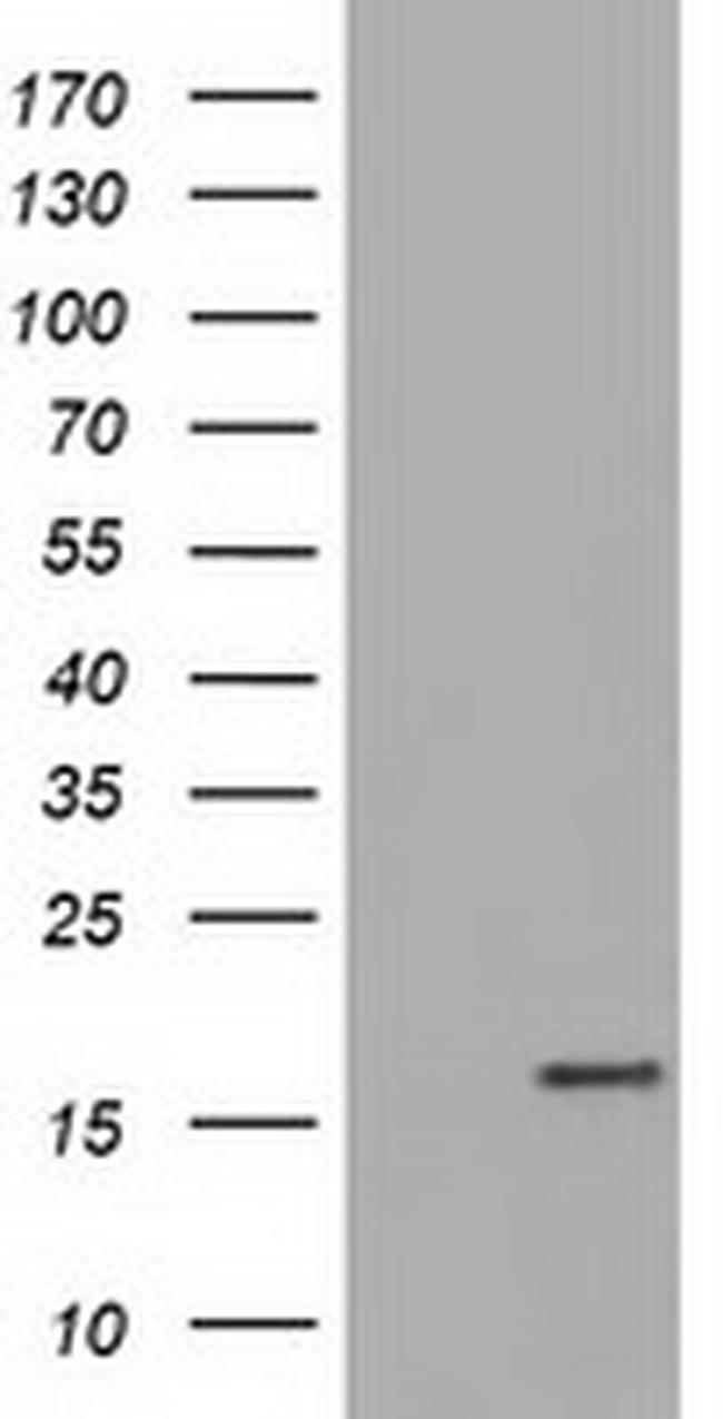TTC32 Antibody in Western Blot (WB)