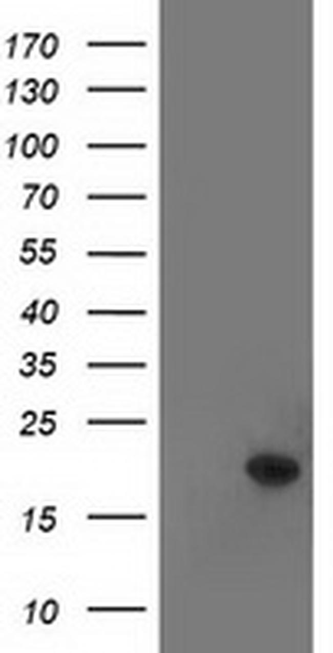 TTC32 Antibody in Western Blot (WB)