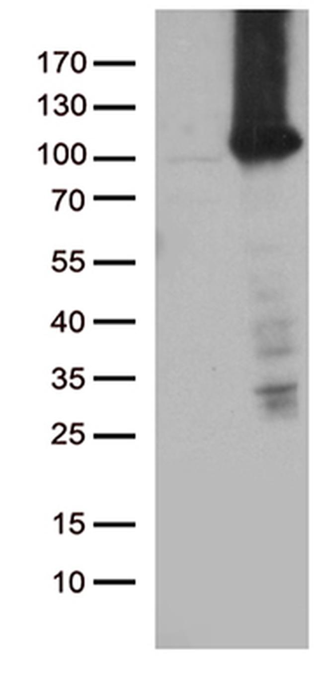 TTC7A Antibody in Western Blot (WB)