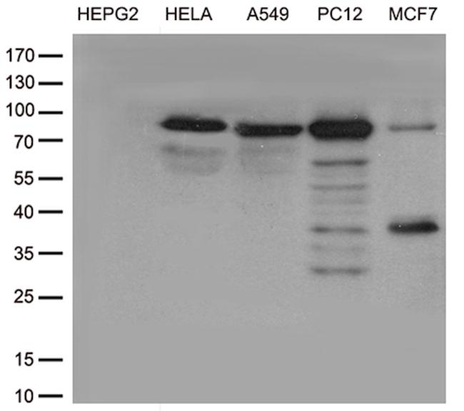 TTC7A Antibody in Western Blot (WB)