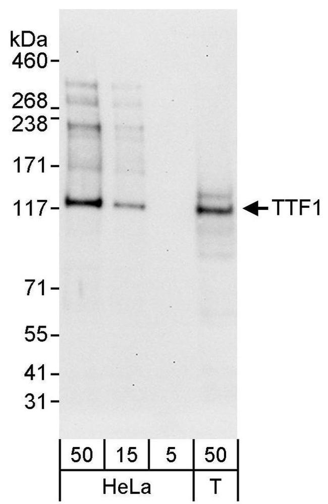 TTF1 Antibody in Western Blot (WB)