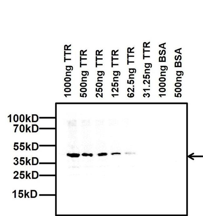 TTR Antibody in Western Blot (WB)