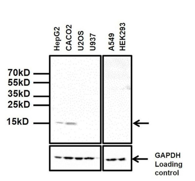 TTR Antibody