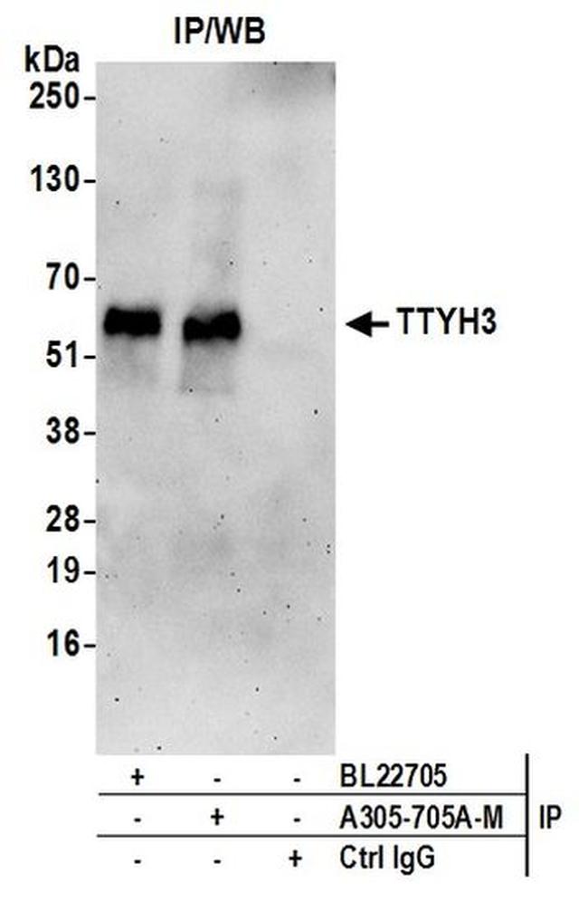 TTYH3 Antibody in Western Blot (WB)