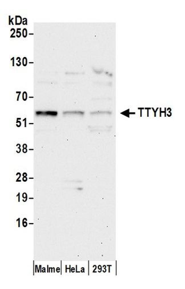 TTYH3 Antibody in Western Blot (WB)