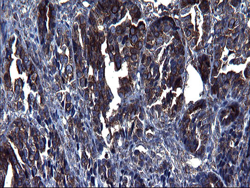 TUBA1A Antibody in Immunohistochemistry (Paraffin) (IHC (P))