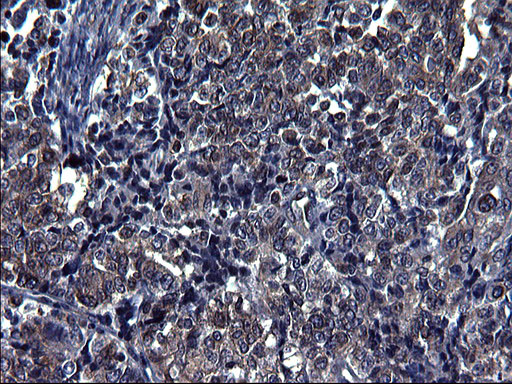 TUBA1A Antibody in Immunohistochemistry (Paraffin) (IHC (P))