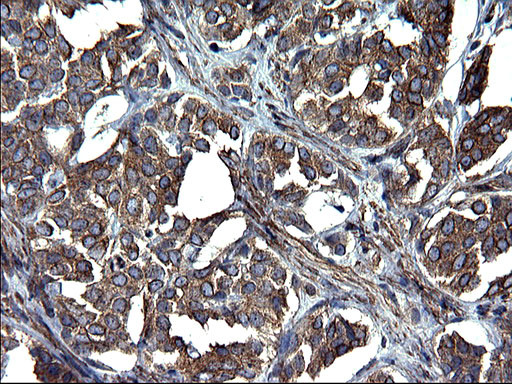 TUBA1A Antibody in Immunohistochemistry (Paraffin) (IHC (P))