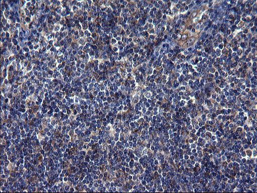 TUBA1A Antibody in Immunohistochemistry (Paraffin) (IHC (P))