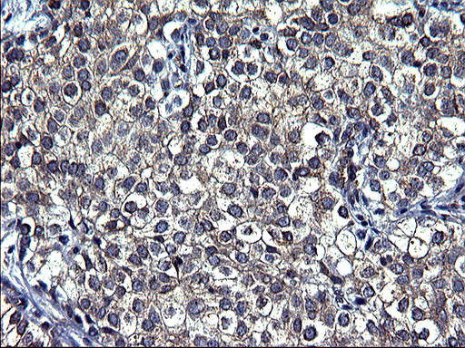 TUBA1A Antibody in Immunohistochemistry (Paraffin) (IHC (P))