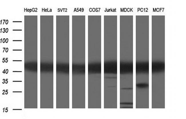 TUBA1A Antibody in Western Blot (WB)