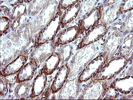 TUBB1 Antibody in Immunohistochemistry (Paraffin) (IHC (P))