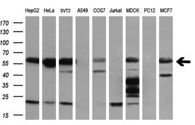 TUBB1 Antibody in Western Blot (WB)