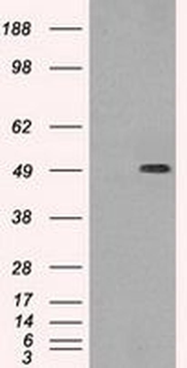 TUBB3 Antibody in Western Blot (WB)
