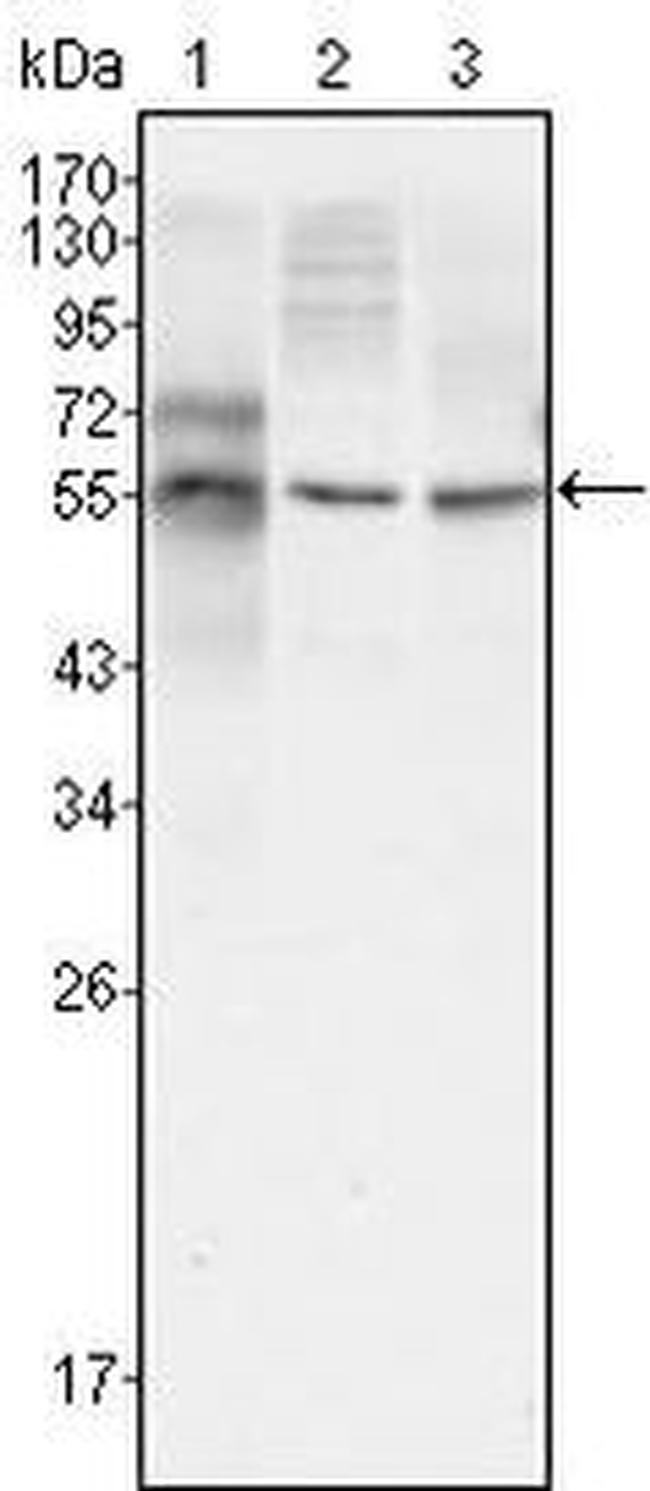 beta-3 Tubulin Antibody in Western Blot (WB)