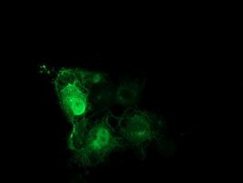 TUBB4 Antibody in Immunocytochemistry (ICC/IF)