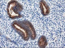 TUBB4 Antibody in Immunohistochemistry (Paraffin) (IHC (P))