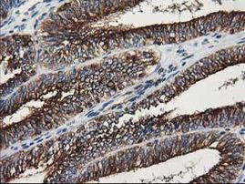 TUBB4 Antibody in Immunohistochemistry (Paraffin) (IHC (P))