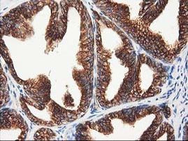 TUBB4 Antibody in Immunohistochemistry (Paraffin) (IHC (P))