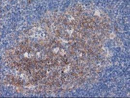 TUBB4 Antibody in Immunohistochemistry (Paraffin) (IHC (P))