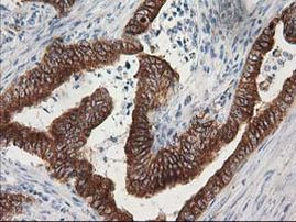 TUBB4 Antibody in Immunohistochemistry (Paraffin) (IHC (P))