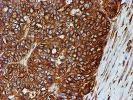 TUBB4 Antibody in Immunohistochemistry (Paraffin) (IHC (P))