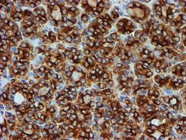 TUBB4 Antibody in Immunohistochemistry (Paraffin) (IHC (P))