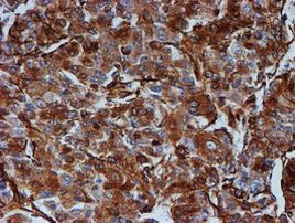 TUBB4 Antibody in Immunohistochemistry (Paraffin) (IHC (P))