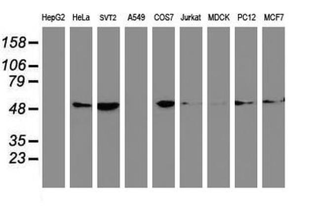 TUBB4 Antibody in Western Blot (WB)