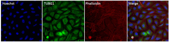 gamma Tubulin Antibody in Immunocytochemistry (ICC/IF)