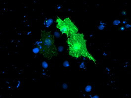 TULP3 Antibody in Immunocytochemistry (ICC/IF)