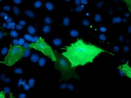 TULP3 Antibody in Immunocytochemistry (ICC/IF)