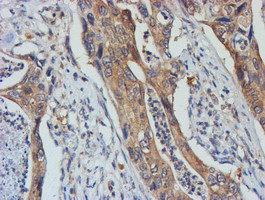 TULP3 Antibody in Immunohistochemistry (Paraffin) (IHC (P))