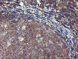 TULP3 Antibody in Immunohistochemistry (Paraffin) (IHC (P))