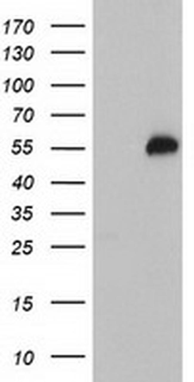 TULP3 Antibody in Western Blot (WB)