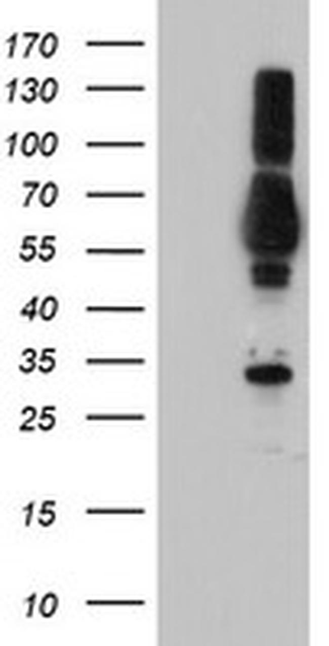 TULP3 Antibody in Western Blot (WB)