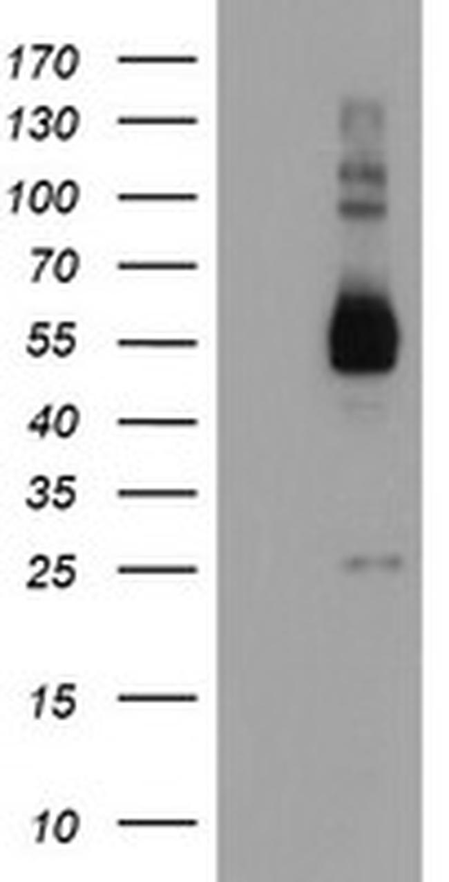 TULP3 Antibody in Western Blot (WB)