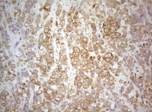 TWF1 Antibody in Immunohistochemistry (Paraffin) (IHC (P))