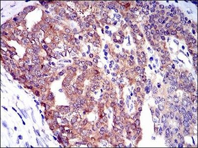 PTK9 Antibody in Immunohistochemistry (Paraffin) (IHC (P))