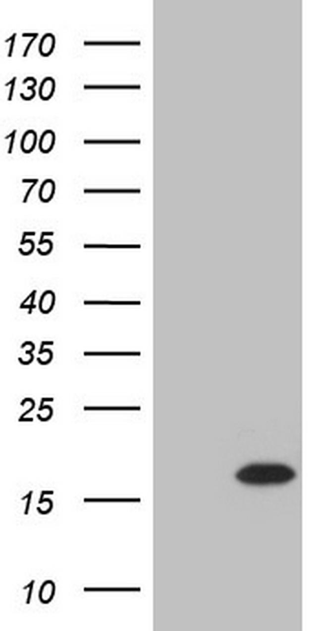 TWIST2 Antibody in Western Blot (WB)