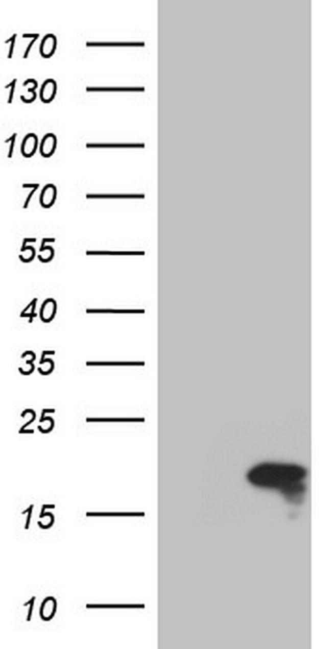 TWIST2 Antibody in Western Blot (WB)