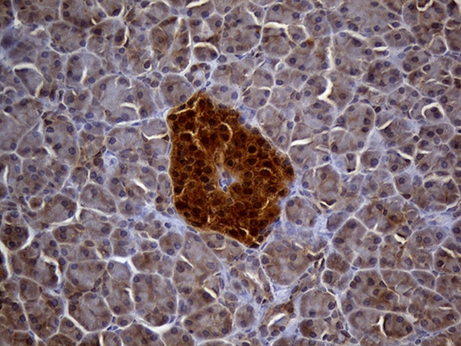 TXNRD1 Antibody in Immunohistochemistry (Paraffin) (IHC (P))