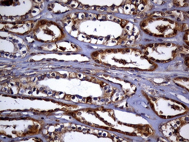 TXNRD1 Antibody in Immunohistochemistry (Paraffin) (IHC (P))