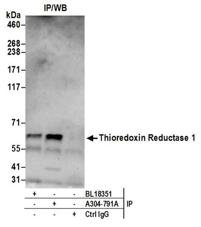 Thioredoxin Reductase 1/TXNRD1/TRXR1 Antibody in Western Blot (WB)