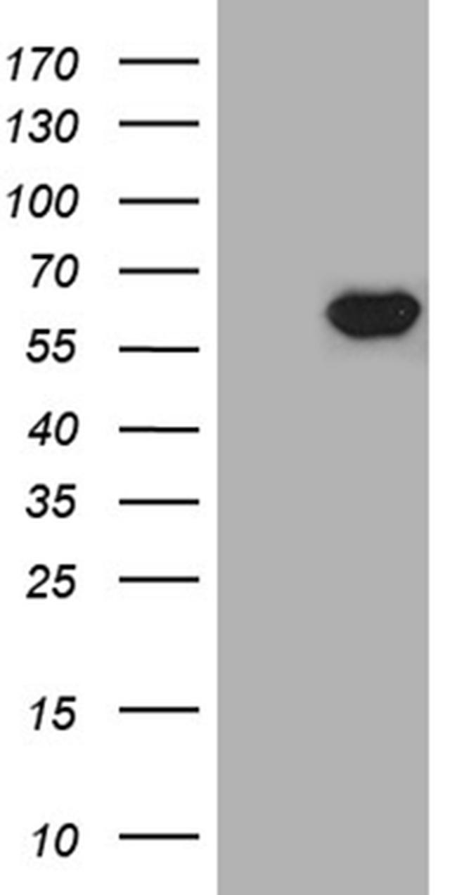 TXNRD1 Antibody in Western Blot (WB)