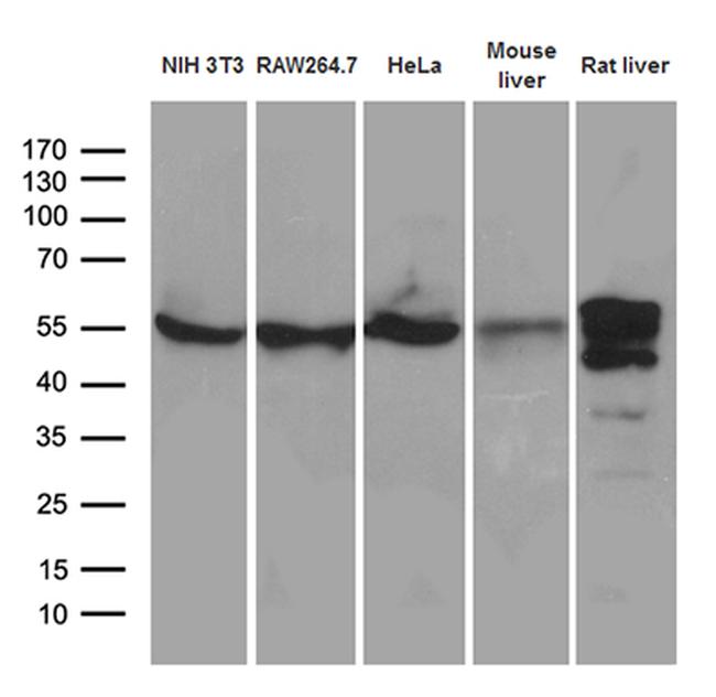 TXNRD1 Antibody in Western Blot (WB)